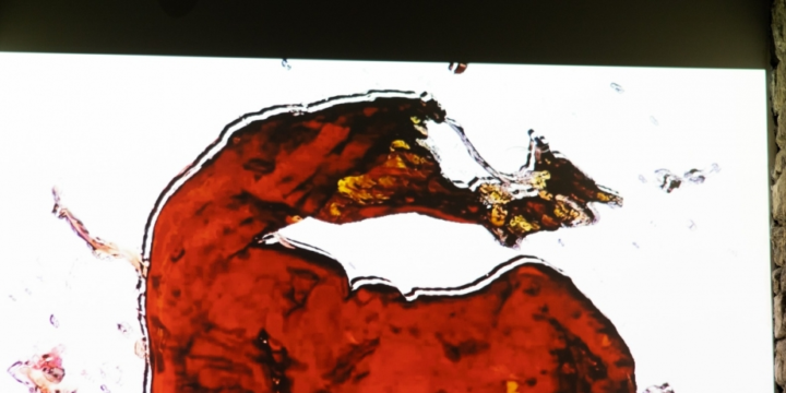 “Artım”da sərgi – “Dərman aradım dərdimə”