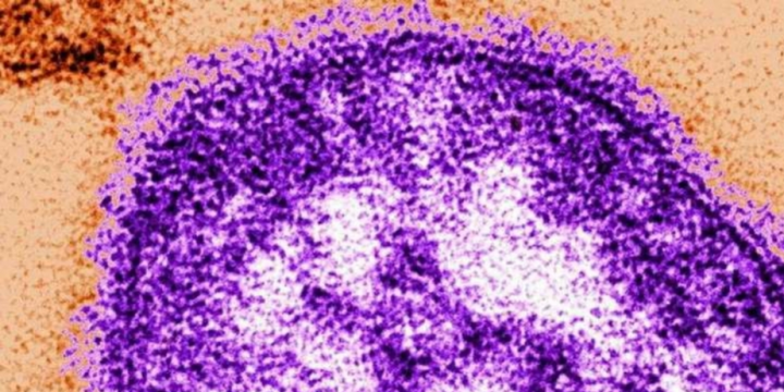 WHO: “Alarming” rise of measles cases in Europe