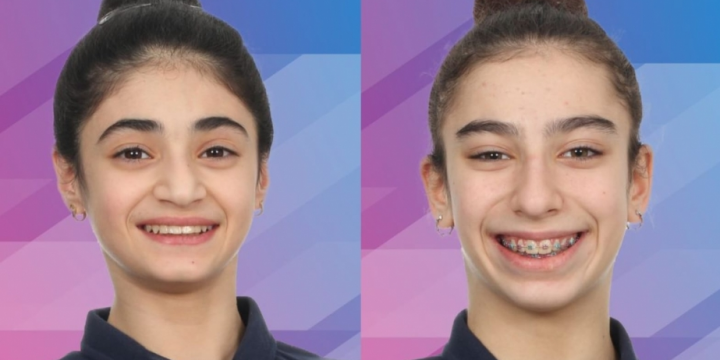 Azerbaijani gymnasts claim two medals at Gymnastic International 2024